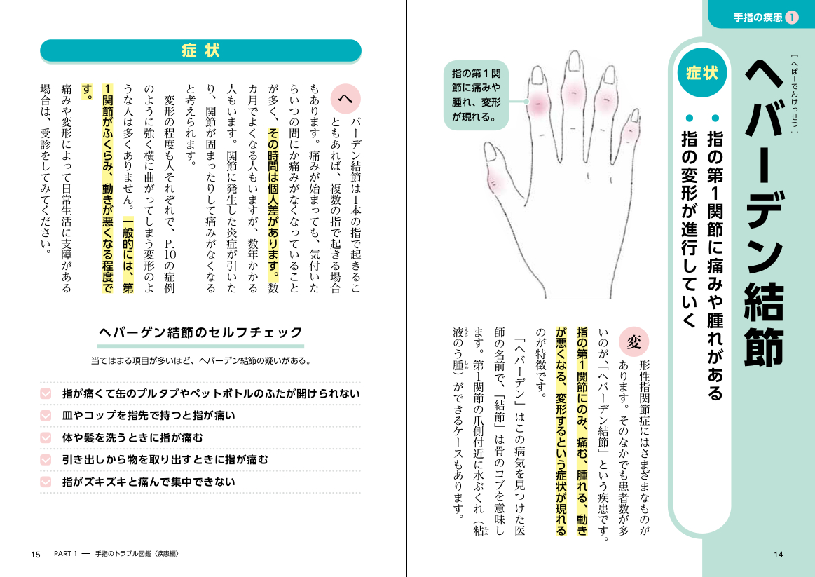 「手指の疾患で代表的な「ヘバーデン結節」の例」紙面