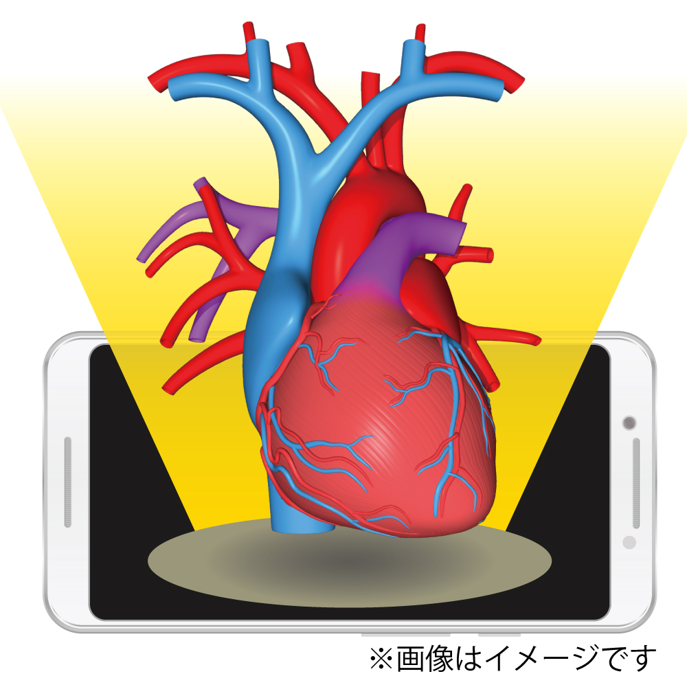 「３Dモデルなら、心臓から出ている血管の方向も立体的にわかる」画像