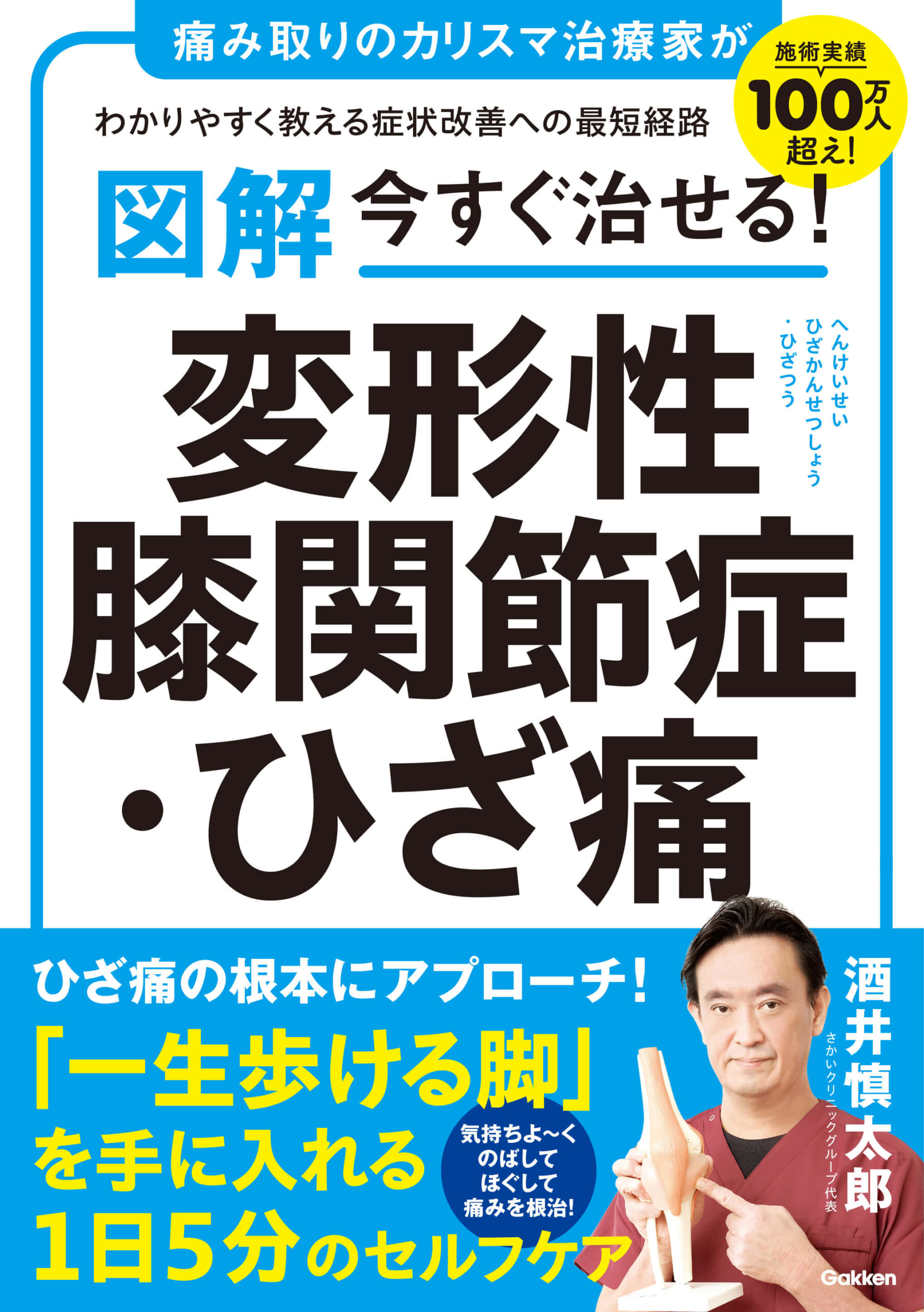 『図解 今すぐ治せる！ 変形性膝関節症・ひざ痛』書影