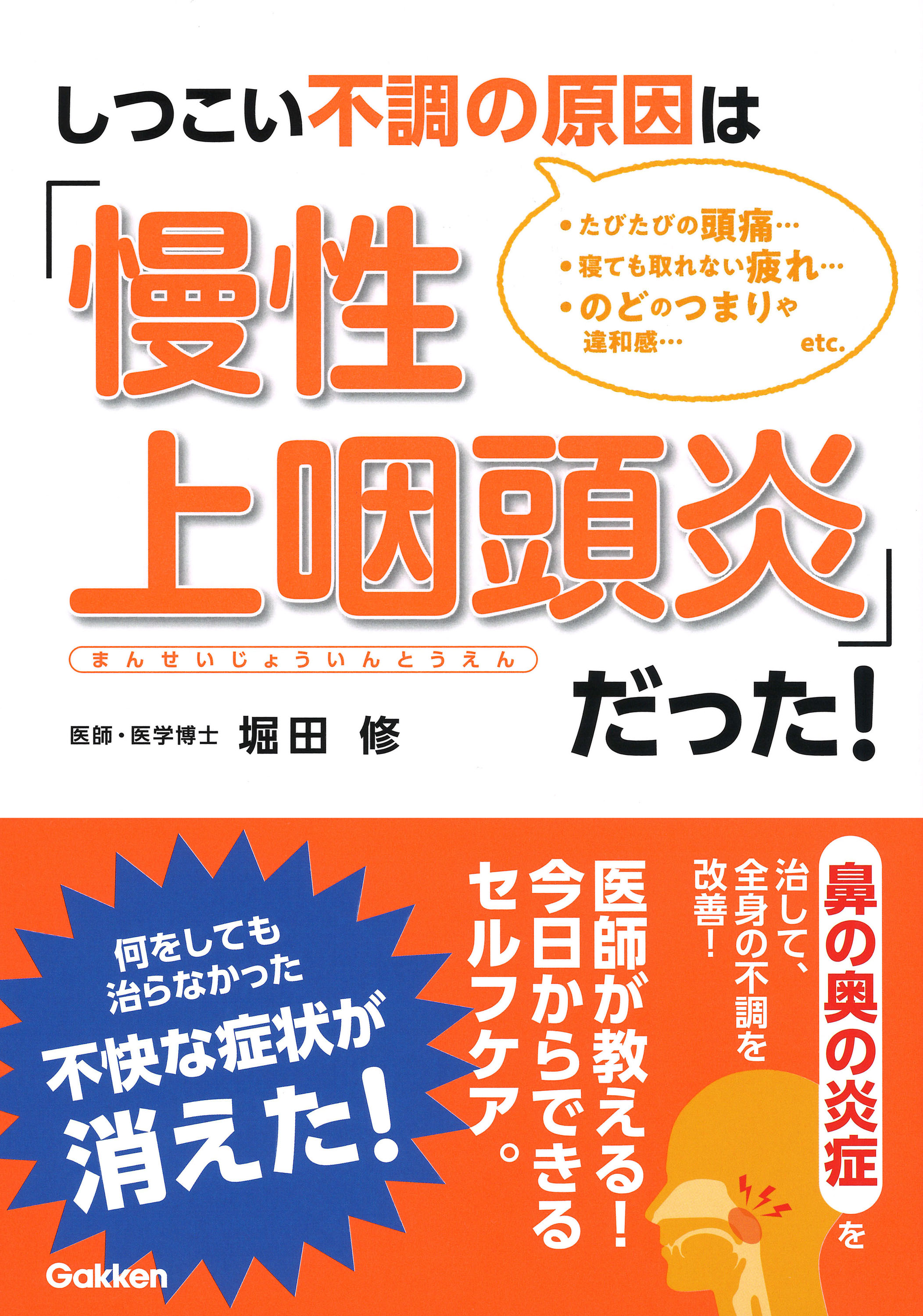 咽頭 炎 上