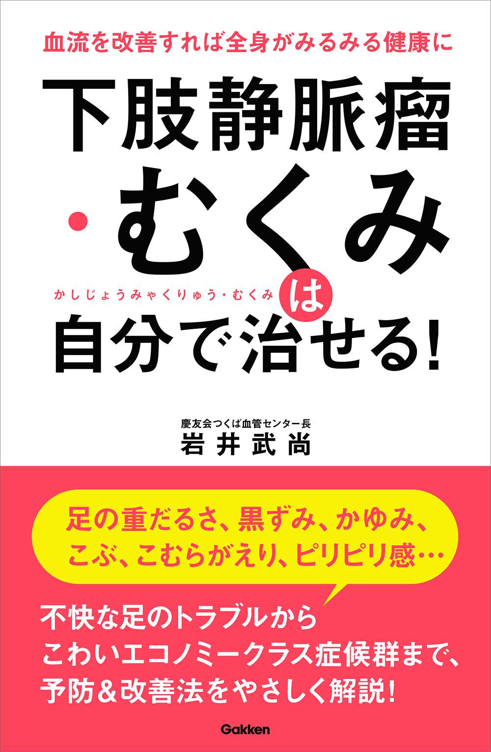 治す 瘤 で 下肢 自分 静脈
